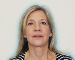 Blepharoplasty Before and After Pictures Buffalo, NY