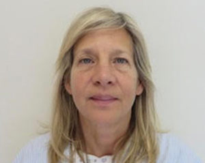 Blepharoplasty Before and After Pictures Buffalo, NY