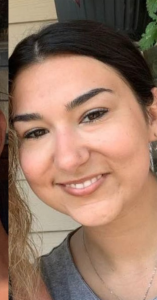 Tear Trough Fillers Before and After Pictures in Buffalo, NY