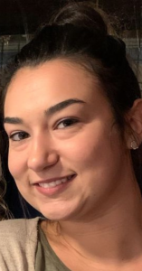 Tear Trough Fillers Before and After Pictures in Buffalo, NY