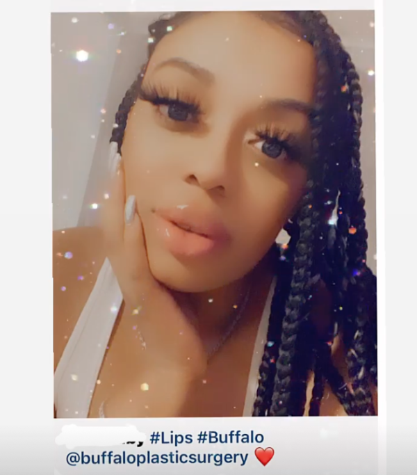 Buffalo Plastic Surgery Selfie Image