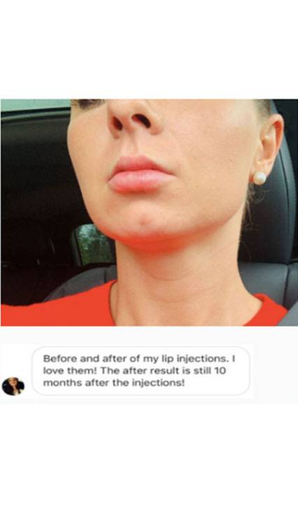 Buffalo Plastic Surgery Selfie Image