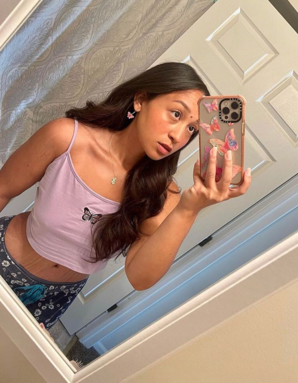 Buffalo Plastic Surgery Selfie Image