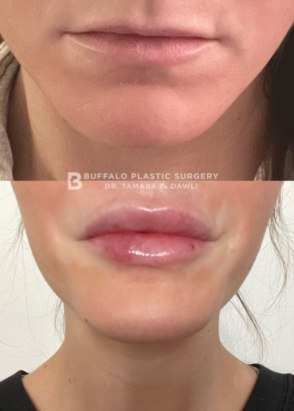 Buffalo Plastic Surgery Selfie Image